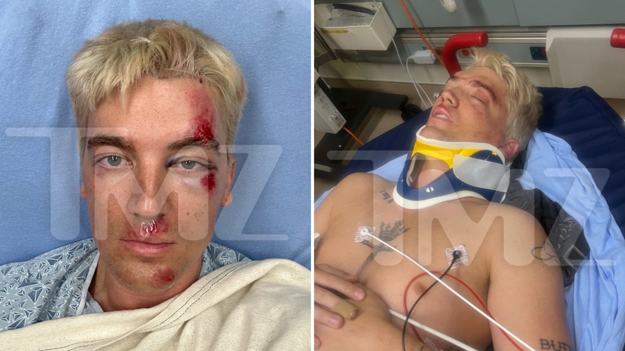 LANY Singer Paul Klein Hit By Car, Posts Pics From Hospital