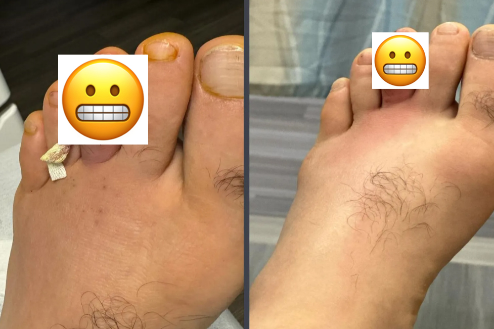 Photos: See Belal Muhammad’s nasty foot injury that forced UFC 310 withdrawal